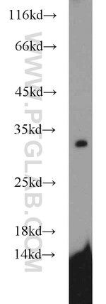 Thumbnail_SDHB Rabbit anti-Human, Mouse, Rat, Polyclonal, Proteintech 150 &mu;L;