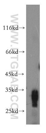 Thumbnail_SDHB Rabbit anti-Human, Mouse, Rat, Polyclonal, Proteintech 150 &mu;L;