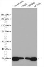 Thumbnail_SDHB Rabbit anti-Human, Mouse, Rat, Polyclonal, Proteintech 150 &mu;L;