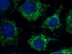 FADS1 Rabbit anti-Human, Mouse, Polyclonal, Proteintech 150 &mu;L; Unconjugated:Antibodies,