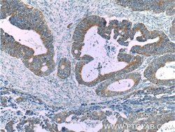 FADS1 Rabbit anti-Human, Mouse, Polyclonal, Proteintech 150 &mu;L; Unconjugated:Antibodies,