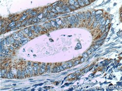 FADS1 Rabbit anti-Human, Mouse, Polyclonal, Proteintech 150 &mu;L; Unconjugated:Antibodies,
