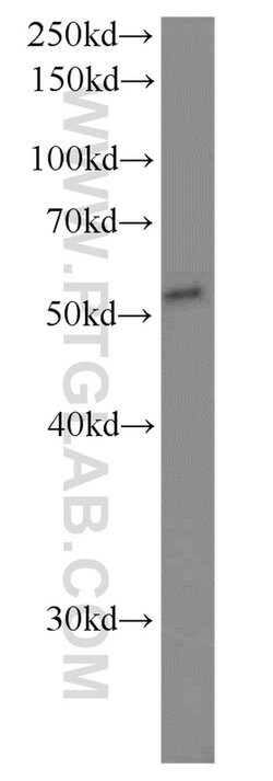 FADS1 Rabbit anti-Human, Mouse, Polyclonal, Proteintech 150 &mu;L; Unconjugated:Antibodies,