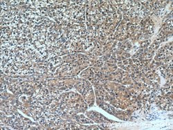 Aminomethyltransferase Rabbit anti-Human, Mouse, Rat, Polyclonal, Proteintech