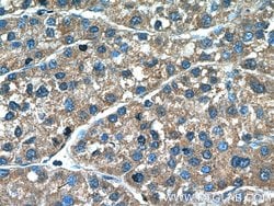Aminomethyltransferase Rabbit anti-Human, Mouse, Rat, Polyclonal, Proteintech