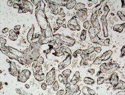Placental Growth Factor Rabbit anti-Human, Polyclonal, Proteintech:Antibodies:Primary