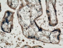 Placental Growth Factor Rabbit anti-Human, Polyclonal, Proteintech:Antibodies:Primary