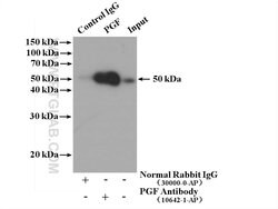 Placental Growth Factor Rabbit anti-Human, Polyclonal, Proteintech:Antibodies:Primary