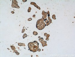 Placental Growth Factor Rabbit anti-Human, Polyclonal, Proteintech:Antibodies:Primary