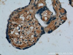 Placental Growth Factor Rabbit anti-Human, Polyclonal, Proteintech:Antibodies:Primary