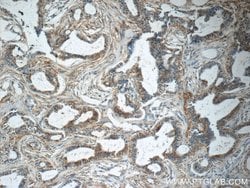 Placental Growth Factor Rabbit anti-Human, Polyclonal, Proteintech:Antibodies:Primary