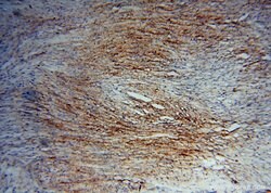 Placental Growth Factor Rabbit anti-Human, Polyclonal, Proteintech:Antibodies:Primary