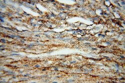 Placental Growth Factor Rabbit anti-Human, Polyclonal, Proteintech:Antibodies:Primary