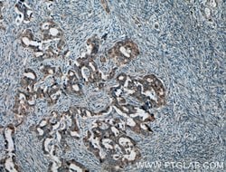 Hsc70 Rabbit anti-Human, Mouse, Rat, Polyclonal, Proteintech:Anticuerpos:Anticuerpos