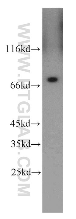 Hsc70 Rabbit anti-Human, Mouse, Rat, Polyclonal, Proteintech:Anticuerpos:Anticuerpos