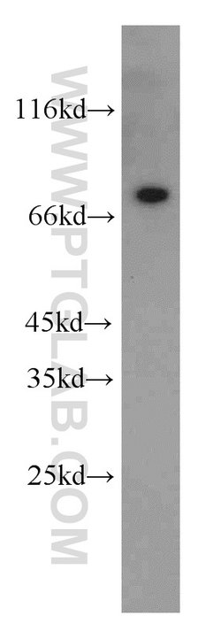 Hsc70 Rabbit anti-Human, Mouse, Rat, Polyclonal, Proteintech:Anticuerpos:Anticuerpos