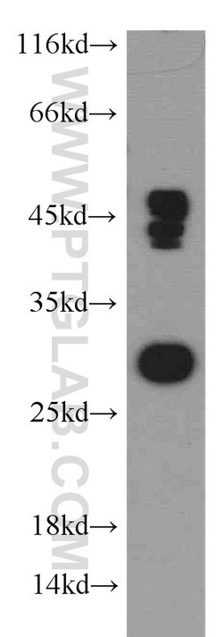 DENR Rabbit anti-Human, Mouse, Rat, Polyclonal, Proteintech 20 &mu;L; Unconjugated:Antibodies,