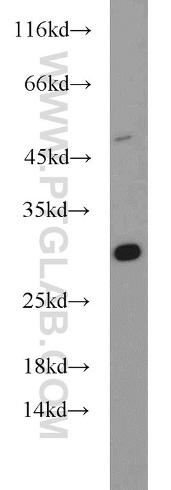 DENR Rabbit anti-Human, Mouse, Rat, Polyclonal, Proteintech 20 &mu;L; Unconjugated:Antibodies,