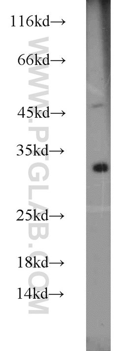 DENR Rabbit anti-Human, Mouse, Rat, Polyclonal, Proteintech 20 &mu;L; Unconjugated:Antibodies,