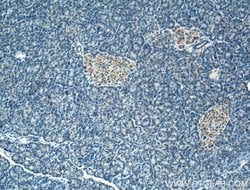 FBXW4 Rabbit anti-Human, Mouse, Rat, Polyclonal, Proteintech:Antibodies:Primary