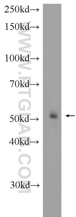 FBXW4 Rabbit anti-Human, Mouse, Rat, Polyclonal, Proteintech:Antibodies:Primary