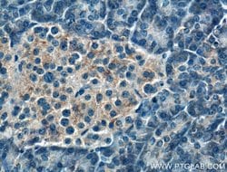 FBXW4 Rabbit anti-Human, Mouse, Rat, Polyclonal, Proteintech:Antibodies:Primary