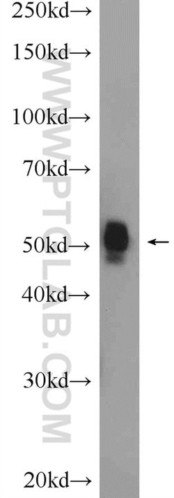 FBXW4 Rabbit anti-Human, Mouse, Rat, Polyclonal, Proteintech:Antibodies:Primary