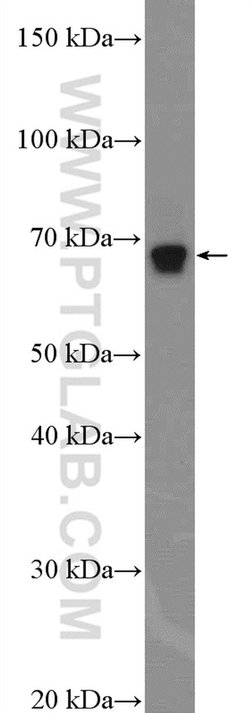 NF2 Rabbit anti-Human, Mouse, Rat, Polyclonal, Proteintech:Antibodies:Primary
