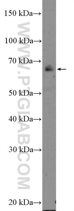 NF2 Rabbit anti-Human, Mouse, Rat, Polyclonal, Proteintech:Antibodies:Primary