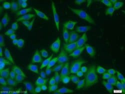 IL18 Rabbit anti-Human, Polyclonal, Proteintech:Antibodies:Primary Antibodies