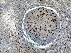 IL18 Rabbit anti-Human, Polyclonal, Proteintech:Antibodies:Primary Antibodies
