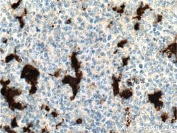 IL18 Rabbit anti-Human, Polyclonal, Proteintech:Antibodies:Primary Antibodies