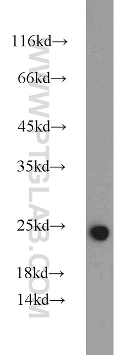 IL18 Rabbit anti-Human, Polyclonal, Proteintech:Antibodies:Primary Antibodies