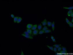 IL18 Rabbit anti-Human, Polyclonal, Proteintech:Antibodies:Primary Antibodies