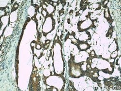 IL18 Rabbit anti-Human, Polyclonal, Proteintech:Antibodies:Primary Antibodies