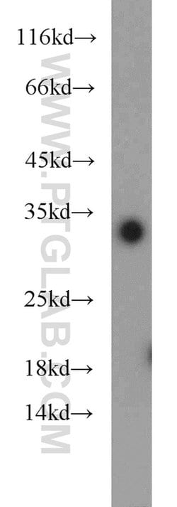 ING5 Rabbit anti-Human, Mouse, Rat, Polyclonal, Proteintech:Antibodies:Primary