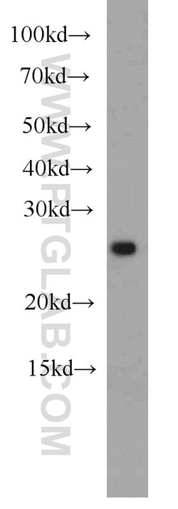 ING5 Rabbit anti-Human, Mouse, Rat, Polyclonal, Proteintech:Antibodies:Primary