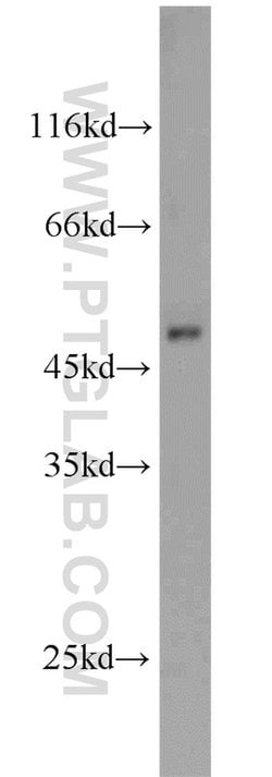 SCLY Rabbit anti-Human, Mouse, Rat, Polyclonal, Proteintech 150 &mu;L;