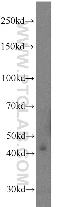 SCLY Rabbit anti-Human, Mouse, Rat, Polyclonal, Proteintech 150 &mu;L;
