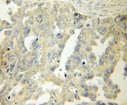 LAMR1/RPSA Rabbit anti-Human, Mouse, Rat, Polyclonal, Proteintech 150 &mu;L;
