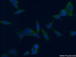 FABP3 Rabbit anti-Human, Mouse, Rat, Polyclonal, Proteintech 150 &mu;L | Buy Online | Proteintech | Fisher Scientific