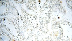 FABP3 Rabbit anti-Human, Mouse, Rat, Polyclonal, Proteintech 150 &mu;L | Buy Online | Proteintech | Fisher Scientific