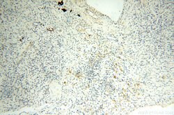 FABP3 Rabbit anti-Human, Mouse, Rat, Polyclonal, Proteintech 150 &mu;L | Buy Online | Proteintech | Fisher Scientific