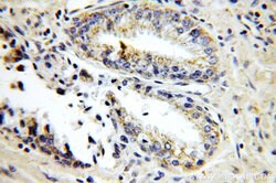 KLK3/PSA Rabbit anti-Human, Polyclonal, Proteintech:Anticuerpos:Anticuerpos