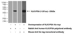 KLK3/PSA Rabbit anti-Human, Polyclonal, Proteintech:Anticuerpos:Anticuerpos