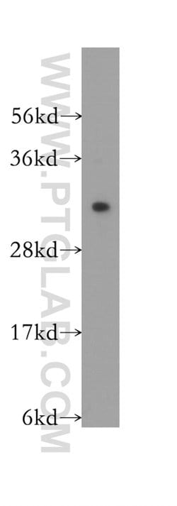TNFSF13 Rabbit anti-Human, Polyclonal, Proteintech:Antibodies:Primary Antibodies