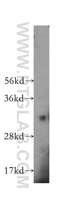 TNFSF13 Rabbit anti-Human, Polyclonal, Proteintech:Antibodies:Primary Antibodies
