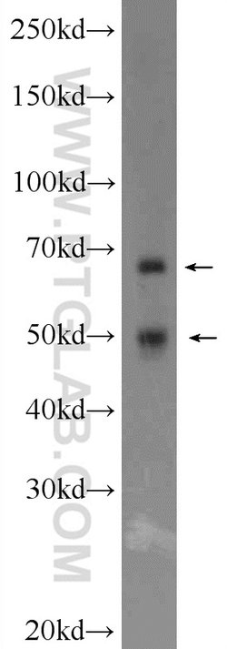CDC23 Rabbit anti-Human, Mouse, Rat, Polyclonal, Proteintech 20 &mu;L | Buy Online | Proteintech | Fisher Scientific