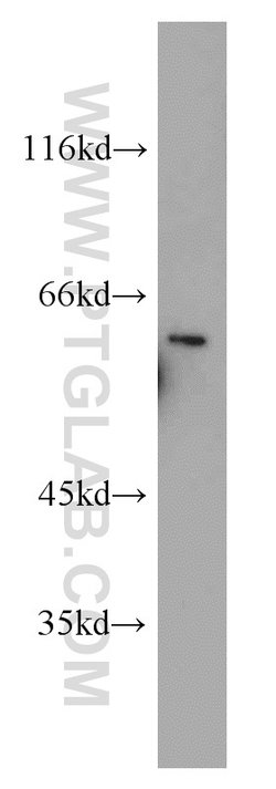 ETV4 Rabbit anti-Human, Mouse, Rat, Polyclonal, Proteintech:Antibodies:Primary