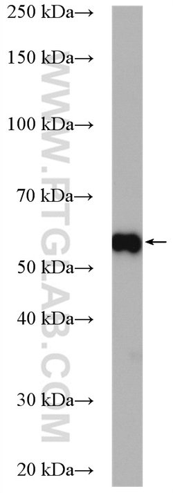 ETV4 Rabbit anti-Human, Mouse, Rat, Polyclonal, Proteintech:Antibodies:Primary
